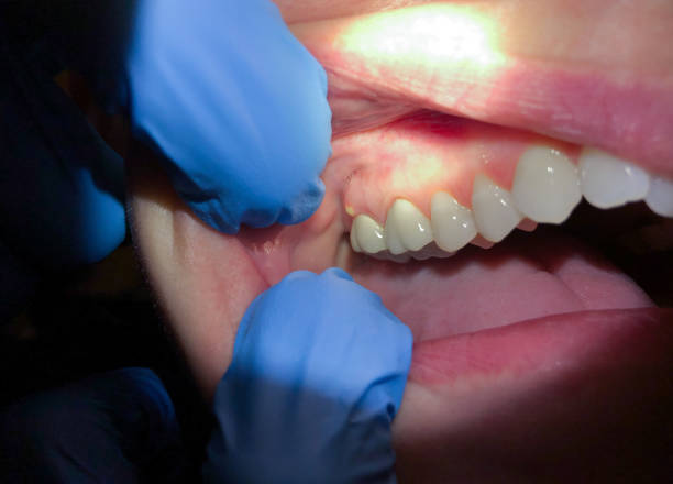  Mcadenville, NC Emergency Dentist Pros