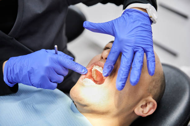 Best Broken or Chipped Tooth Repair in Mcadenville, NC