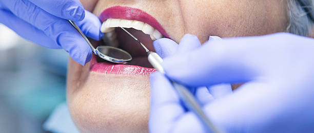Best Emergency Root Canal Therapy in Mcadenville, NC